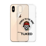 Stoned to the Bone Clear iPhone Case